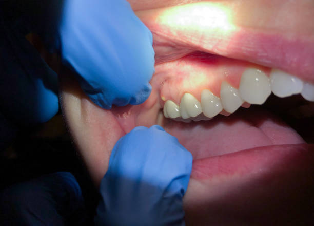 Best Emergency Cosmetic Dentistry in Hendersonville, TN
