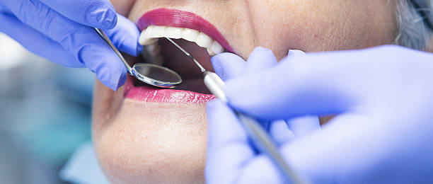 Best Emergency Dentist for Lost Fillings or Crowns in Hendersonville, TN